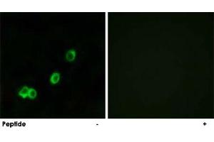 Immunofluorescence analysis of MCF-7 cells, using ACOT1 polyclonal antibody .