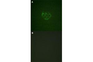Immunofluorescence staining of methanol-fixed A-549 cells with TNK2 (phospho Y284) polyclonal antibody  without blocking peptide (A) or preincubated with blocking peptide (B) at 1:100-1:200 dilution.