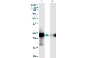 Western Blot analysis of CITED1 expression in transfected 293T cell line by CITED1 monoclonal antibody (M02), clone 6C1.