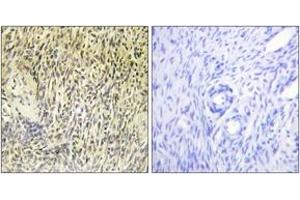 Immunohistochemistry (IHC) image for anti-Spleen tyrosine Kinase (SYK) (AA 289-338) antibody (ABIN2888703) (SYK anticorps  (AA 289-338))