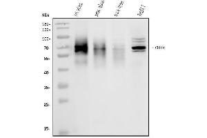 Western blot analysis of CD226 using anti-CD226 antibody (ABIN7601264).