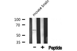 Western blot analysis of Phospho-AKT1(Thr308) expression in Mouse brain lysate (AKT1 anticorps  (pThr308))
