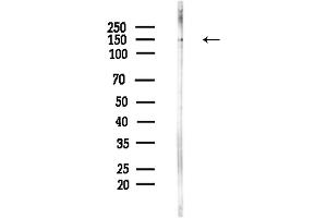 Western blot analysis of lysates from Hela cells(LPS,4h treatment), using Phospho-NFAT1 (Ser53) Antibody at 1/1000 dilution.