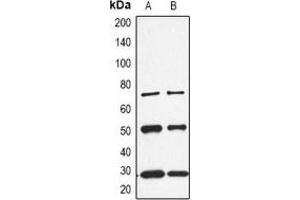 Western blot analysis of CALB1 expression in K562 (A), rat kidney (B) whole cell lysates. (CALB1 anticorps  (C-Term))