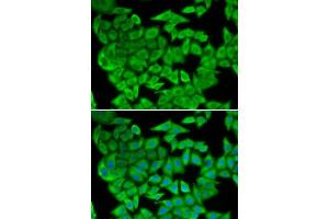 Immunofluorescence analysis of U2OS cells using MDH2 antibody. (MDH2 anticorps  (AA 59-338))