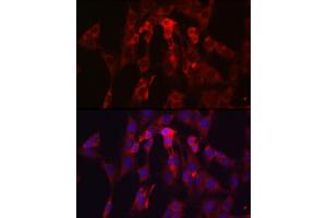 Immunofluorescence analysis of C6 cells using TIMP2 Rabbit pAb (ABIN3022132, ABIN3022133, ABIN1513608, ABIN1514751 and ABIN6218618) at dilution of 1:250 (40x lens). (TIMP2 anticorps  (AA 100-200))