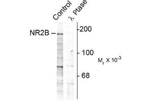 Image no. 1 for anti-Glutamate Receptor, Ionotropic, N-Methyl D-Aspartate 2B (GRIN2B) (pTyr1252) antibody (ABIN372685)