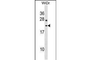 Western blot analysis in WiDr cell line lysates (35ug/lane). (LYZL6 anticorps  (AA 37-65))