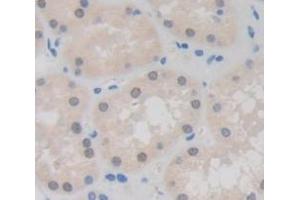 IHC-P analysis of Human Tissue, with DAB staining. (HIST2H2AA3 anticorps  (AA 1-130))