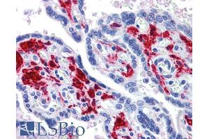 ABIN6391376 (3. (DDX58 anticorps  (C-Term))