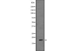 Western blot analysis of HES5 expression in 293 cell lysate ,The lane on the left is treated with the antigen-specific peptide. (HES5 anticorps  (Internal Region))
