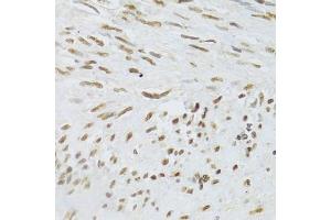 Immunohistochemistry of paraffin-embedded human uterus using DDB1 Antibody (ABIN5971498) at dilution of 1/100 (40x lens). (DDB1 anticorps)