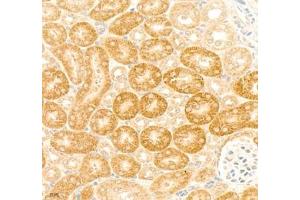 Immunohistochemistry of paraffin embedded mouse kidney using collagen alpha-1 (V) (ABIN7073547) at dilution of 1: 1800 (400x lens) (Collagen Type V anticorps)