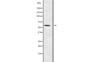Western blot analysis of NOC4L expression in NOC4L transfected 293T cell lysate;,The lane on the left is treated with the antigen-specific peptide. (NOC4L anticorps  (Internal Region))