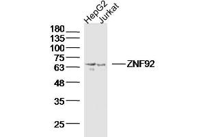 Lane 1: Hepg2 lysates Lane 2: Jurkat lysates probed with ZNF92 Polyclonal Antibody, Unconjugated  at 1:300 dilution and 4˚C overnight incubation. (ZNF92 anticorps  (AA 21-120))