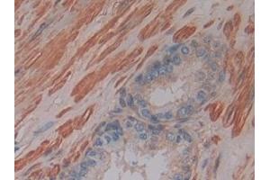 Detection of GSTm4 in Human Prostate Tissue using Polyclonal Antibody to Glutathione S Transferase Mu 4 (GSTm4)