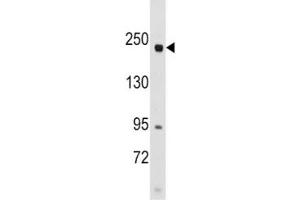 Western blot analysis of RICTOR antibody and SK-BR-3 lysate. (RICTOR anticorps  (AA 236-267))