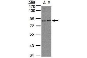 WB Image Sample(30 ug whole cell lysate) A:A431, B:H1299 7.