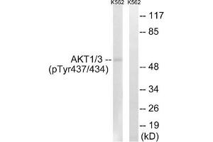 Western blot analysis of extracts from K562 cells, treated with insulin (0. (AKT1/3 (pTyr437) anticorps)