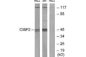 Western blot analysis of extracts from HeLa cells and 293 cells, using CtBP2 antibody. (CTBP2 anticorps)