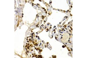 Immunohistochemistry of paraffin-embedded human lung using DP1/DP1/TFDP1 antibody (ABIN6130313, ABIN6149038, ABIN6149040 and ABIN6221075) at dilution of 1:200 (40x lens). (DP1 anticorps  (AA 1-290))