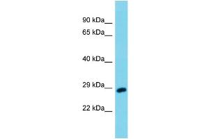 Host: Rabbit Target Name: Uchl3 Sample Type: Mouse Testis lysates Antibody Dilution: 1. (UCHL3 anticorps  (Middle Region))