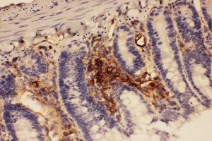 Anti-ICAM1 Picoband antibody,  IHC(P): Rat Intestine Tissue