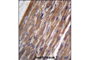 FBLIM1 Antibody (C-term) (ABIN656647 and ABIN2845889) immunohistochemistry analysis in formalin fixed and paraffin embedded human heart tissue followed by peroxidase conjugation of the secondary antibody and DAB staining. (FBLIM1 anticorps  (C-Term))