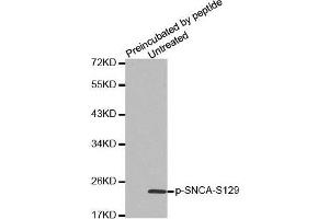 Western Blotting (WB) image for anti-Synuclein, alpha (SNCA) (pSer129) antibody (ABIN1682058) (SNCA anticorps  (pSer129))