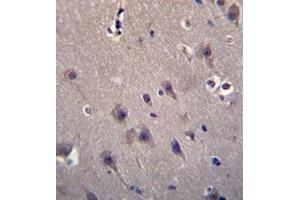 Immunohistochemistry analysis in formalin fixed and paraffin embedded human brain tissue reacted with MCF2 Antibody (C-term) followed which was peroxidase conjugated to the secondary antibody and followed by DAB staining.