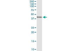 Immunoprecipitation of TRDMT1 transfected lysate using anti-TRDMT1 MaxPab rabbit polyclonal antibody and Protein A Magnetic Bead , and immunoblotted with TRDMT1 purified MaxPab mouse polyclonal antibody (B01P) .