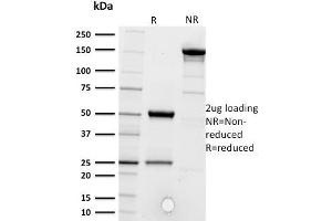 SDS-PAGE Analysis Purified CD5-Monospecific Mouse Monoclonal Antibody (CD5/2416). (CD5 anticorps  (AA 269-366))