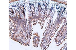 IHC analysis of Filamin B/FLNB using anti-Filamin B/FLNB antibody (ABIN7601607).