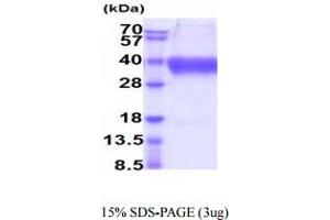 SDS-PAGE (SDS) image for V-Set Domain Containing T Cell Activation Inhibitor 1 (VTCN1) (AA 25-259) protein (His tag) (ABIN6388048)