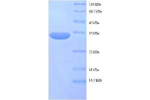 50S Ribosomal Protein L32 (AA 2-57), (full length) protein (GST tag)