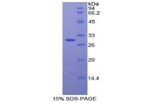 SDS-PAGE analysis of Rat Catenin beta 1 Protein. (CTNNB1 Protéine)