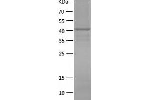 Western Blotting (WB) image for Fibroblast Growth Factor Receptor 1 (FGFR1) (AA 624-822) protein (His-IF2DI Tag) (ABIN7122955) (FGFR1 Protein (AA 624-822) (His-IF2DI Tag))