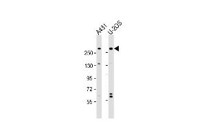 All lanes : Anti-NBAS Antibody (N-Term) at 1:2000 dilution Lane 1: A431 whole cell lysate Lane 2: U-2OS whole cell lysate Lysates/proteins at 20 μg per lane. (NBAS anticorps  (AA 628-661))