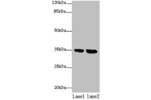 Western blot All lanes: TMEM165 antibody at 8 μg/mL Lane 1: Jurkat whole cell lysate Lane 2: Hela whole cell lysate Secondary Goat polyclonal to rabbit IgG at 1/10000 dilution Predicted band size: 35, 29 kDa Observed band size: 35 kDa (TMEM165 anticorps  (AA 173-228))