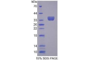 Image no. 1 for Transcription Elongation Factor A (SII), 3 (TCEA3) (AA 59-347) protein (His tag) (ABIN6239631) (TCEA3 Protein (AA 59-347) (His tag))