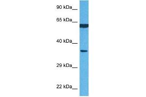 Host:  Rabbit  Target Name:  P4HB  Sample Tissue:  Human MCF7 Whole Cell  Antibody Dilution:  1ug/ml (P4HB anticorps  (N-Term))