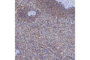 IHC analysis of TRMT61A using anti-TRMT61A antibody (ABIN7599220). (TRMT61A anticorps  (AA 1-289))