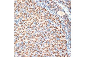 Immunohistochemistry of paraffin-embedded rat ovary using Slit2 Rabbit mAb (ABIN7270335) at dilution of 1:100 (40x lens). (SLIT2 anticorps)