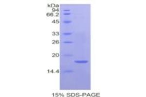 SDS-PAGE of Protein Standard from the Kit  (Highly purified E.