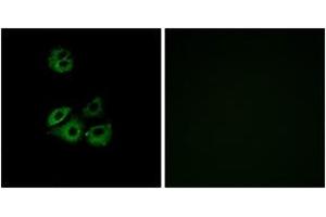 Immunofluorescence analysis of A549 cells, using CCBP2 Antibody. (CCBP2 anticorps  (AA 335-384))