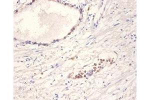 Immunohistochemistry of paraffin-embedded human prostate tissue using ABIN7161468 at dilution of 1:100 (Neurotrophin 4 anticorps  (AA 82-210))