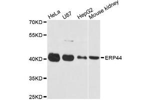 Western blot analysis of extracts of various cell lines, using ERP44 antibody (ABIN5972576) at 1:3000 dilution. (ERP44 anticorps)