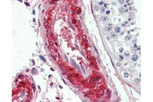 Immunohistochemical analysis of paraffin-embedded human vessels tissues using LPP mouse mAb.
