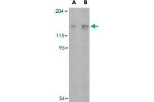 Western blot analysis of Rptor in L1210 cell lysate with Rptor polyclonal antibody  at (A) 2 and (B) 4 ug/mL . (Raptor anticorps  (C-Term))