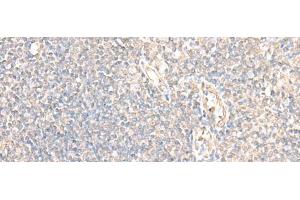 Immunohistochemistry of paraffin-embedded Human tonsil tissue using PARS2 Polyclonal Antibody at dilution of 1:30(x200) (PARS2 anticorps)